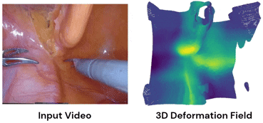 Tracking-Aware Deformation Field Estimation for Non-rigid 3D Reconstruction in Robotic Surgeries