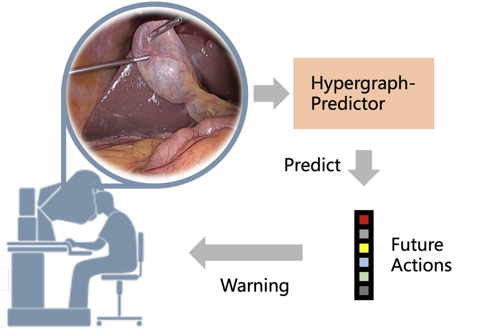 Hypergraph-Transformer (HGT) for Interactive Event Prediction in Laparoscopic and Robotic Surgery