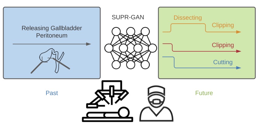 SUPR-GAN: SUrgical PRediction GAN for Event Anticipation in Laparoscopic and Robotic Surgery