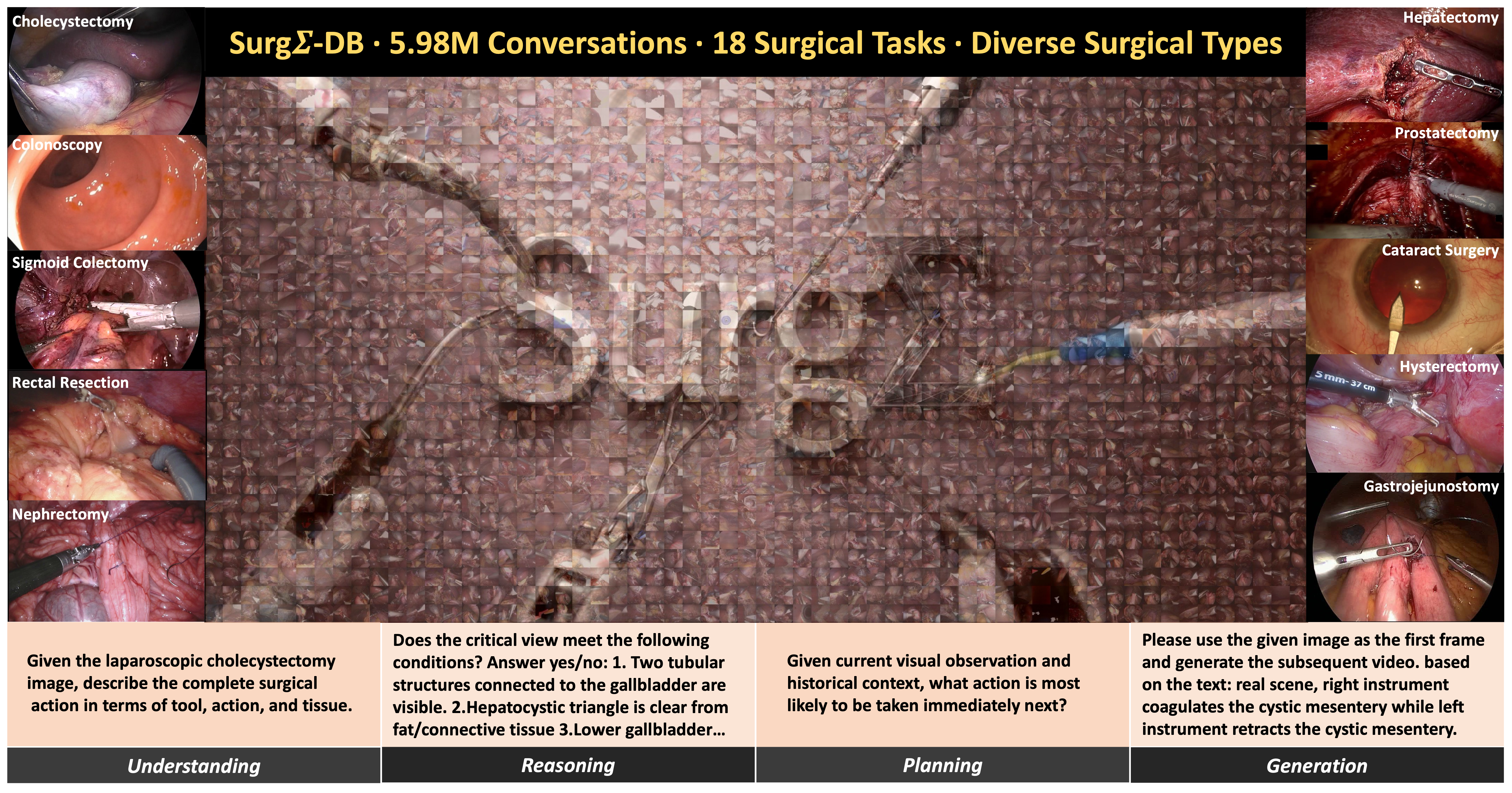 SurgΣ: A Spectrum of Large-Scale Multimodal Data and Foundation Models for Surgical Intelligence