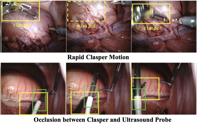 Temporal Propagation of Asymmetric Feature Pyramid for Surgical Scene Segmentation